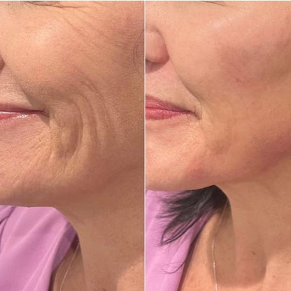 FaceLift Micro Wand 2.0