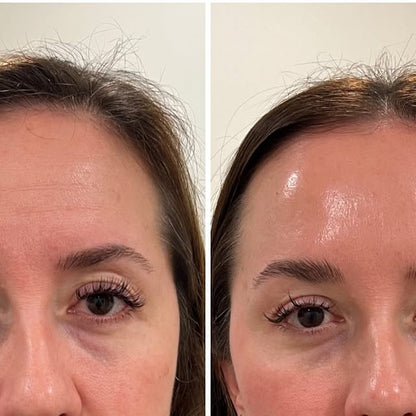 FaceLift Micro Wand 2.0