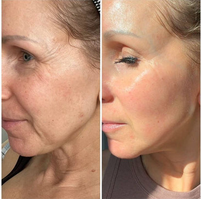 FaceLift Micro Wand 2.0