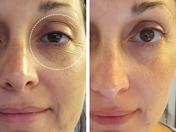 FaceLift Micro Wand 2.0