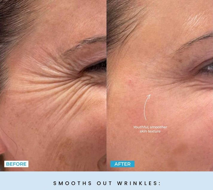 FaceLift Micro Wand 2.0