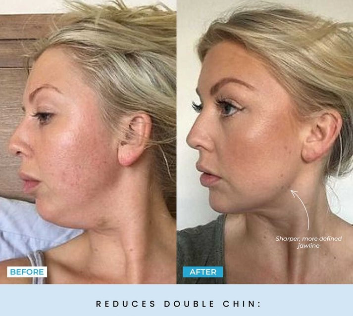 FaceLift Micro Wand 2.0
