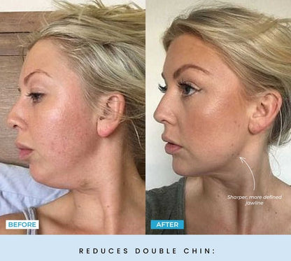 FaceLift Micro Wand 2.0